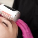 Veido atjauninimas „Young & Lift“ aparatinis masažas